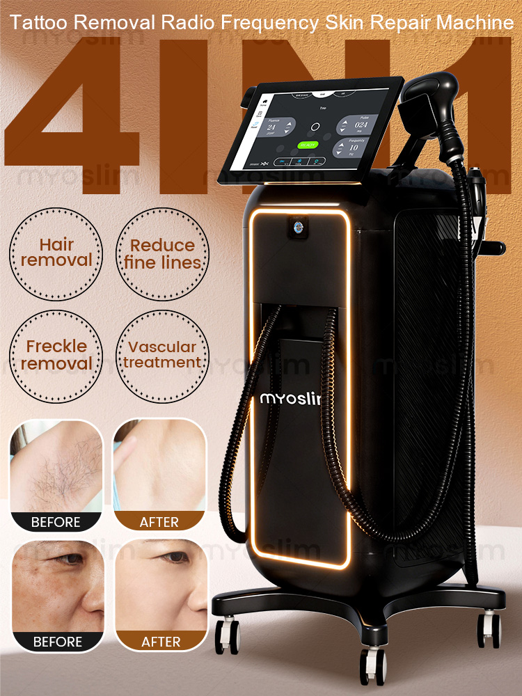 4 IN 1 Soprano Titanium Ice Pl - Industrial Laser Hair Removal Machine review and price